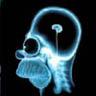 E-Ray of Homers Brain 